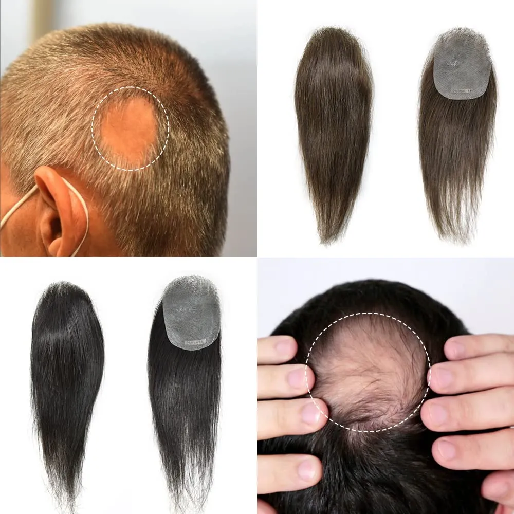 Bald Spot Hair Patch For Men V-Looped Remy Human Hair Patch For Bald Spot Natural lookimg Hair Replacement Unit Thin Skin Hair Piece for Bald Spot Hair Systems (#1B OFF BLACK, 4cm X 8cm - 14 INCH)