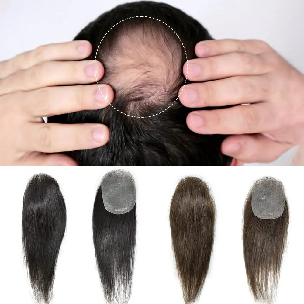 Bald Spot Hair Patch For Men V-Looped Remy Human Hair Patch For Bald Spot Natural lookimg Hair Replacement Unit Thin Skin Hair Piece for Bald Spot Hair Systems (#1B OFF BLACK, 4cm X 8cm - 14 INCH)