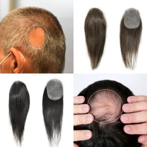 Bald Spot Hair Patch For Men V-Looped Remy Human Hair Patch For Bald Spot Natural lookimg Hair Replacement Unit Thin Skin Hair Piece for Bald Spot Hair Systems (#2 DARKEST BROWN, 4cm X 8cm - 14 INCH)