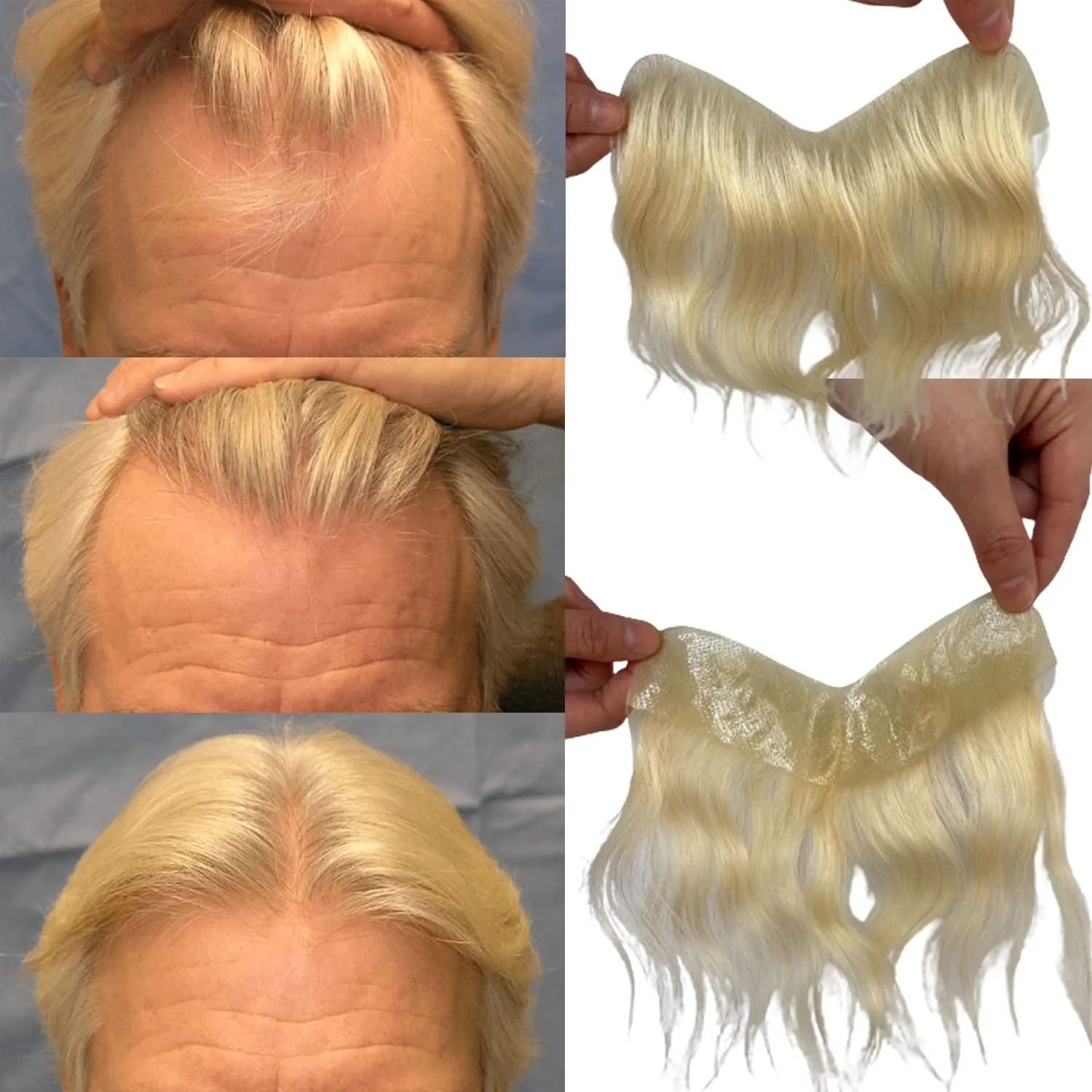 Men Forehead Hairline Toupee 100% Human Hair Skin PU Man Hairpieces Frontal Hair Topper for Receding Natural Hairline Replacement Systems #613 Blonde Color 0.78x6.29INCH