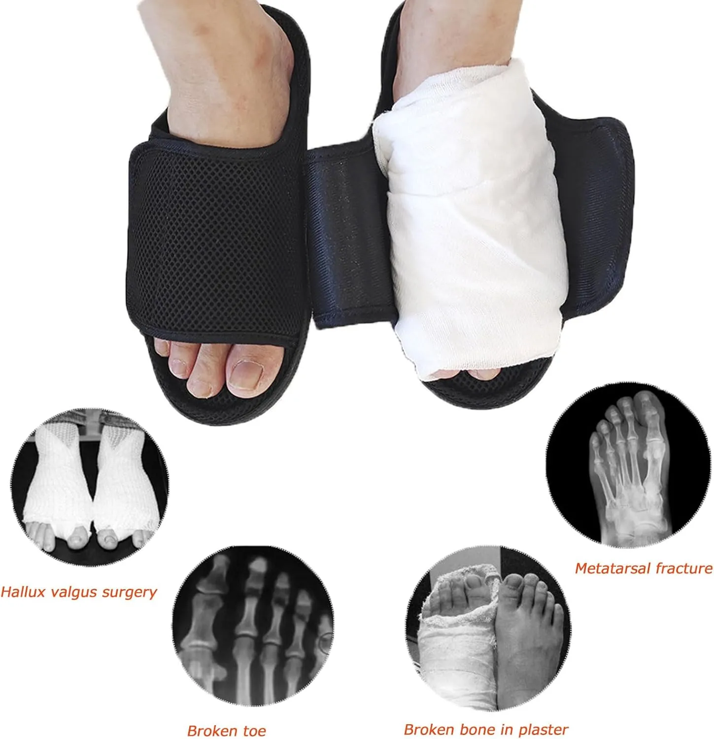 Unisex Open Toe Diabetic Shoes, Extra Wide Arthritis Edema Shoes, Medical Open Toe Cast Shoes for Swollen Feet Edema Footwear Indoor Outdoor Black